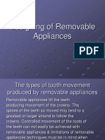 Designing of Removable Appliances (DRA)