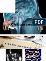 Cisticerco y Toxocaras