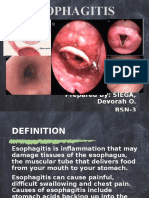 Esophagitis: Prepared By: SIEGA, Devorah O. BSN-3