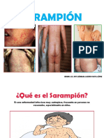 Sarampión: síntomas, prevención y vacunación