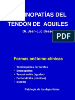 10- Tendinitis Del Aquiles (1)