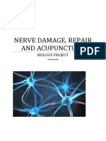 Nerve Pain and Nerve Damage 2