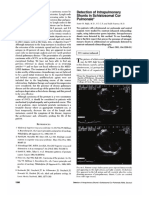 CHEST, 104, 4, OCTOBER, 1993-Detection of Intrapulmonary Shunts in Schistosomal Cor Pulmonale