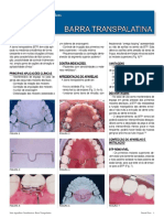 CONFECCION DE ARCO TRANSPALATINO.pdf