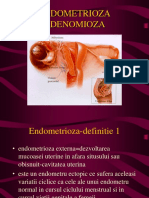 245919984 Endometrioza Si Adenomioza
