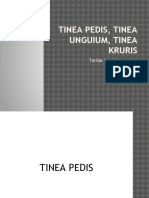 315135114-Tinea.pptx