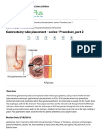 Gastrostomy Tube Placement - Series-Procedure, Part 2 - MedlinePlus Medical Encyclopedia