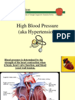 High Blood Pressure (Aka Hypertension)