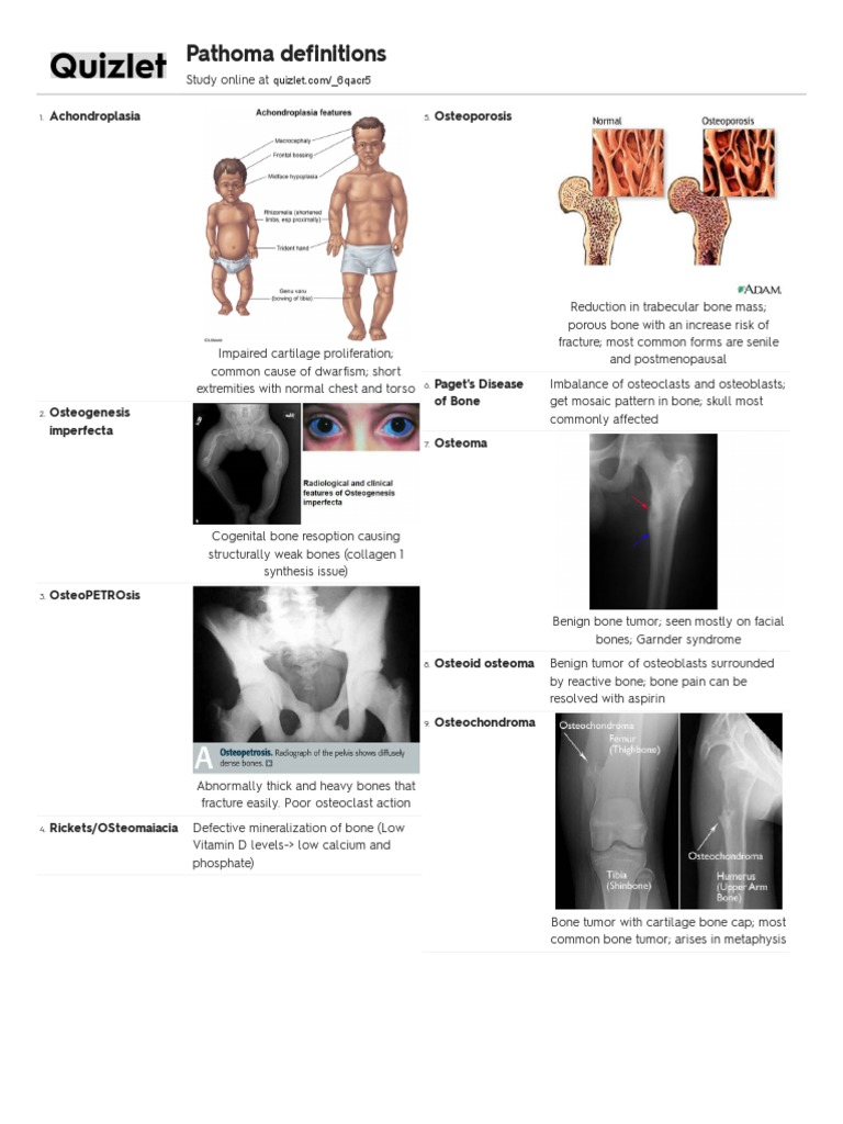 Pathoma Overview: Bone Disorders and Tumors | PDF | Necrosis | Bone