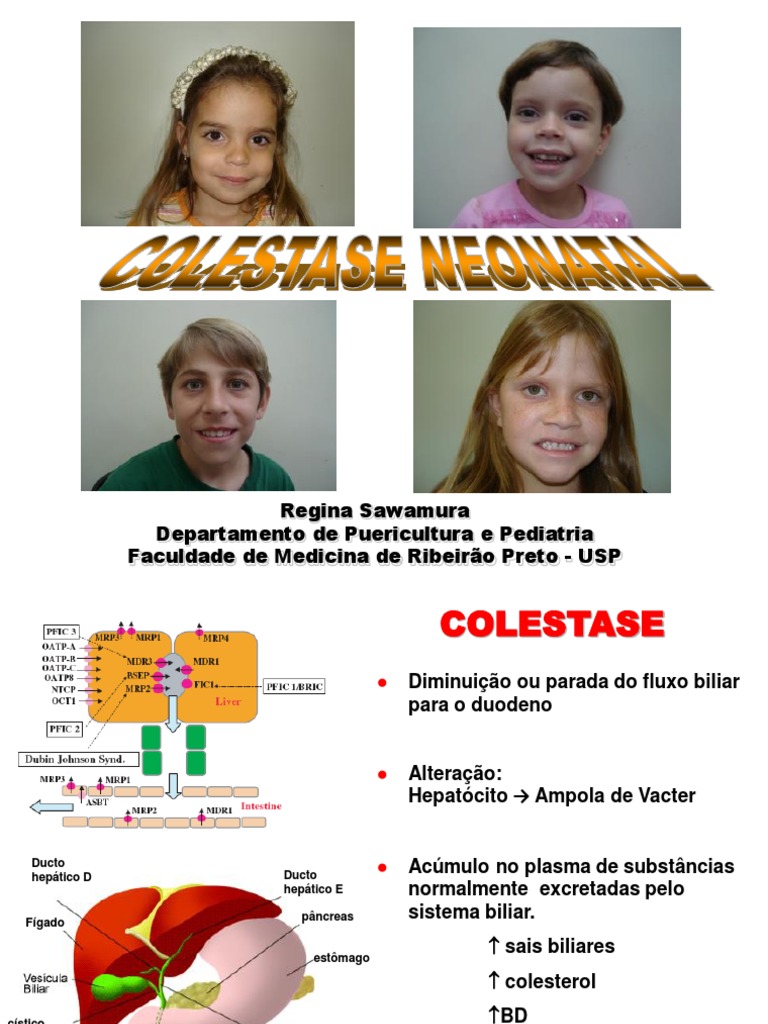 Icterícia e colestase neonatal