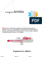 Hipertermia