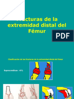  Fractura Del Extremo Distal Del Femur
