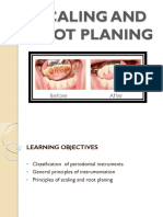 Scaling and Root Planing Presentation - DR - Naaz Gill