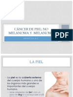 CA de Piel - Melanoma