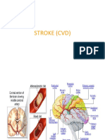 Stroke (CVD)