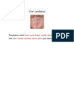 Oral Candidosis