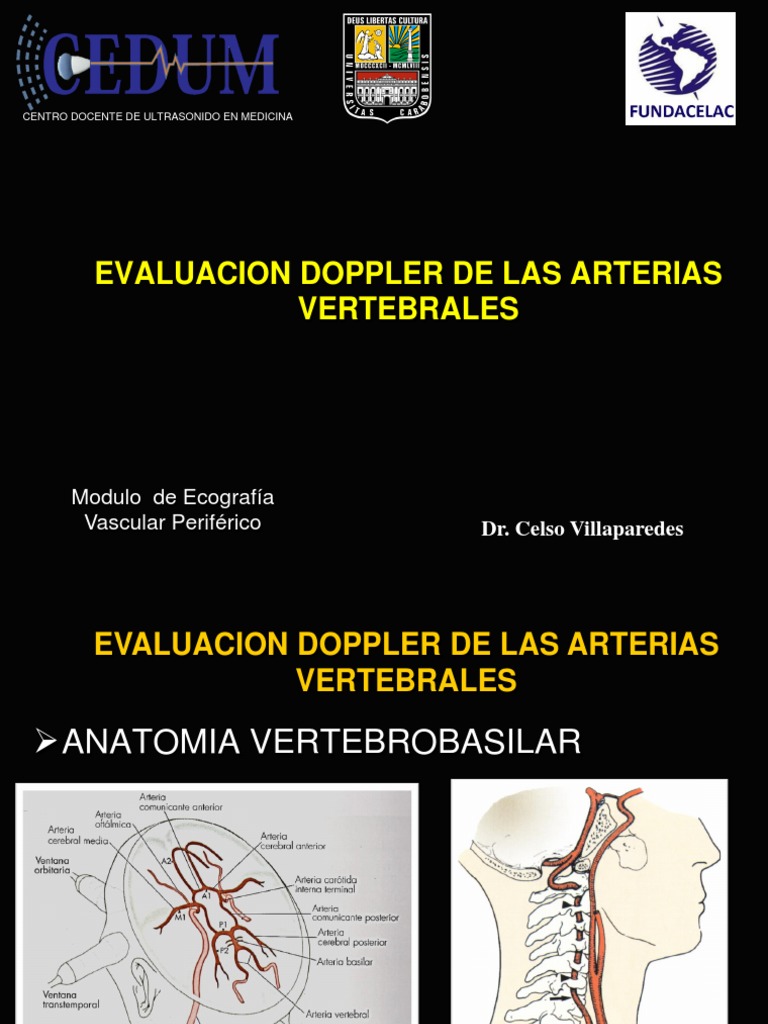 Evaluación Doppler de Arterias Vertebrales | PDF | Artería | Vértebra, image size:768x1024