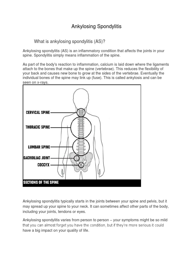 Ankylosing Spondylitis | PDF | Analgesic | Physical Therapy