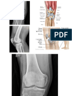 imagen rodilla