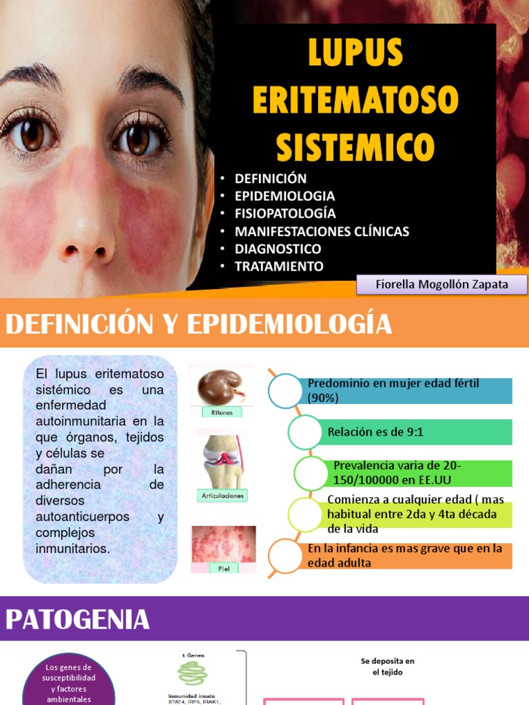 Lupus Eritematoso Sistémico | PDF | Lupus eritematoso sistémico | Rtt
