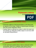 Pulmonary Edema by DR Gireesh Kumar K P