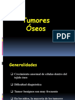 Tumores Oseos