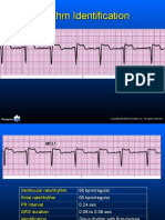 Practice ECGStrips