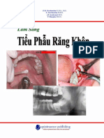 Tiểu Phẫu Răng Khôn