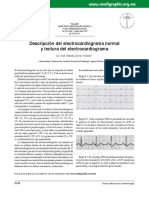 Electrocardiografía básica para anestesiólogos