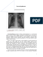 Cancerul Pulmonar