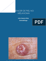 Cancer de Piel No Melanoma