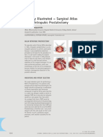 Millin prostatectomy.pdf