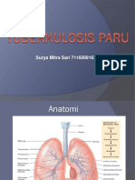 Tuberculosis