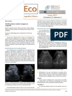 litiasis renal.pdf