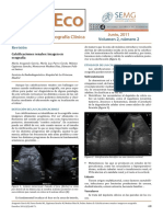 Litiasis Renal PDF