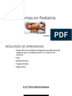 Arritmias en Pediatria Complementario Lectura PDF