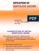 Kennedy's Classification of Partial Edentulous Arches