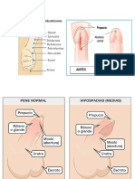 hipospadia.docx