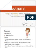 Gastritis: Is An, Irritation, or Erosion of The Lining of The - It Can Occur Suddenly (Acute) or Gradually (Chronic)
