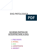 Ekg Patologica
