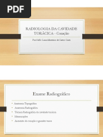 Radiologia Da Cavidade Torácica - Avaliação Coração