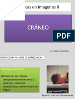 Craneo - 2018-1
