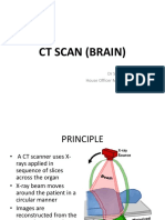 CT Scan (Brain) : DR Sana Rehman House Officer Medical Unit I