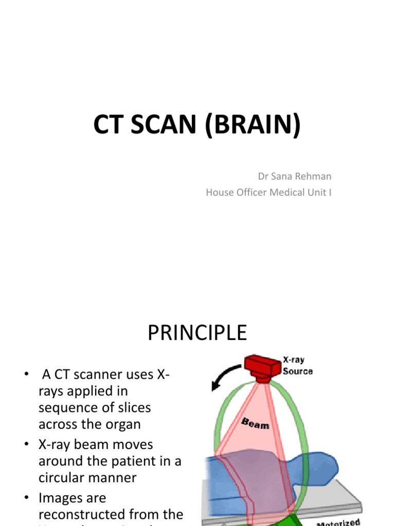 Interpreting Common Neurological Findings on CT Scans of the Brain PDF Ct Scan Headache