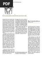 B-Lynch Suturing Surgical Technique Guide | PDF | Uterus | Surgical Suture