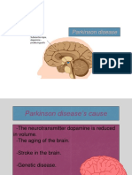 Parkinson