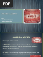 Mordida Abierta (2)