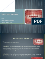 Mordida Abierta (2)