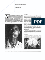 Recurrent Intestinal Obstruction in a Case of Peutz-Jegher Syndrome