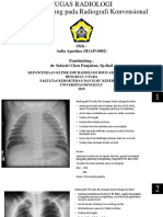 Tugas Radiologi Ekspertise Jantung (Aulia Agustina)